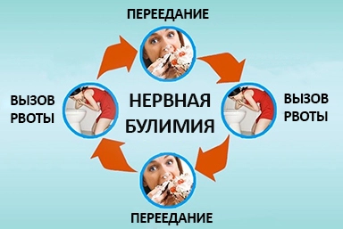 Лечение булимии в Хомутово
